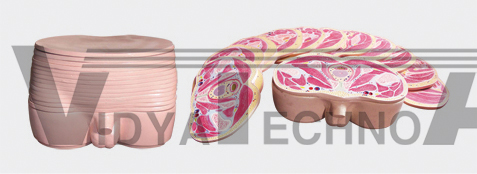 The dissection model of male pelvis transection layer